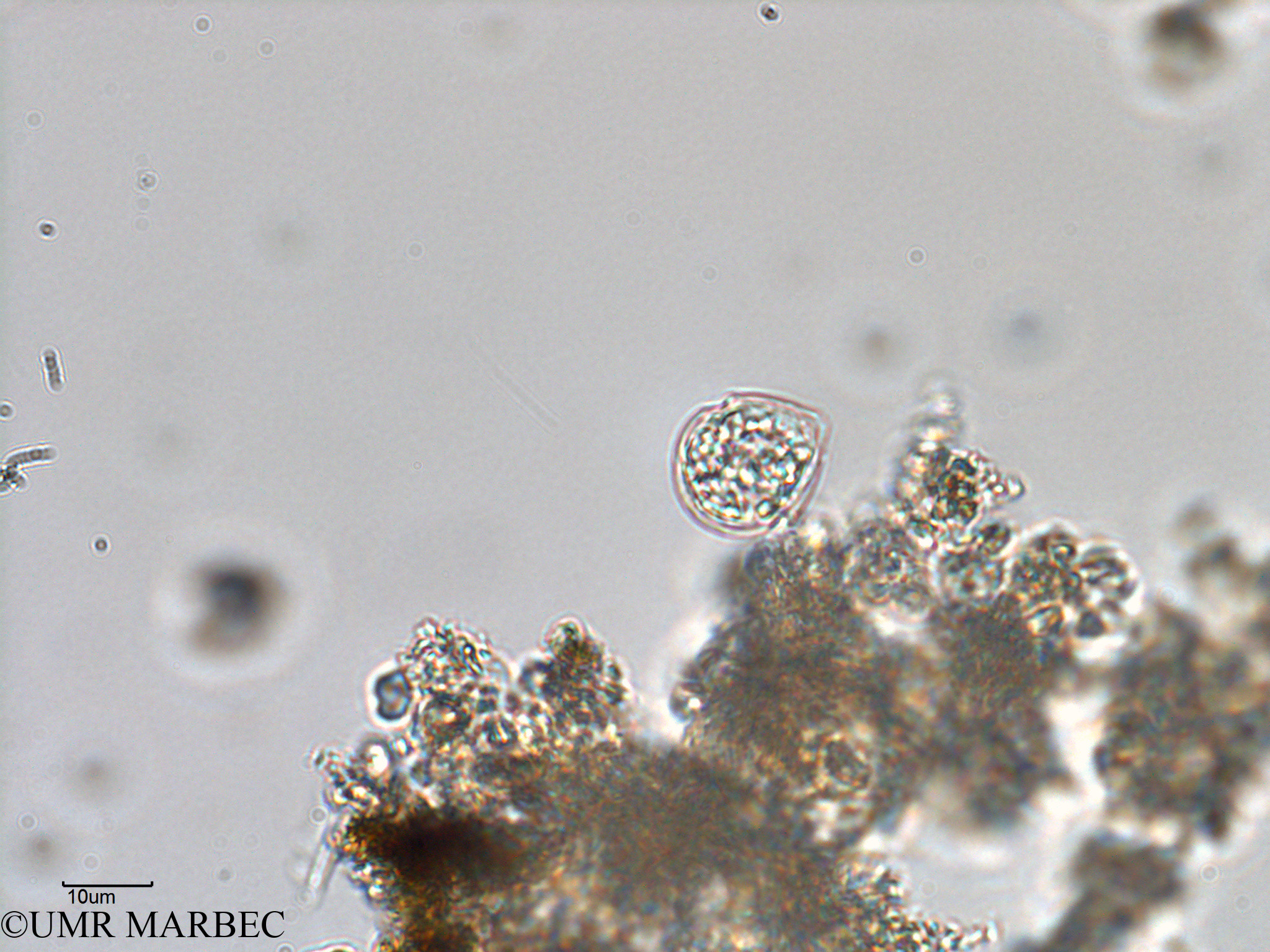 phyto/Bizerte/bizerte_bay/RISCO February 2015/Scrippsiella trochoidea (old Scrippsiella spp -ancien Baie_T5-C2-Scrippsiella spp).tif(copy).jpg